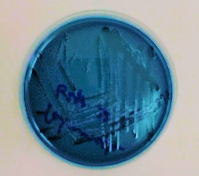 Inmunodeprimidos, grupos de riesgo, Alimenta Acción