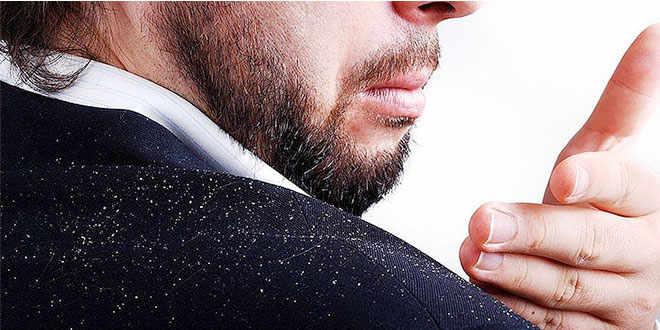 Remedios naturales para la caspa