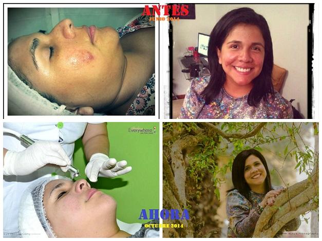 Dpilate_Peru_Fashion Everywhere_AnaLópez_Fashion_Everywhere_Ana_López_www.fashioneverywhere.pe_1 (30)