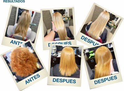 Tratamientos taninoplastia