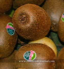 Diagnóstico del ERGE