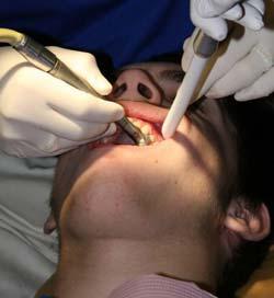 ¿Existen opciones naturales para cuidar la salud dental?