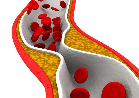 La disfunción endotelial