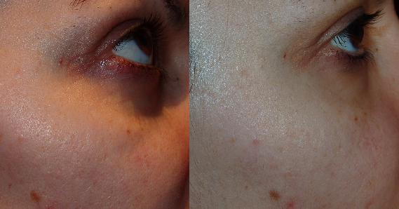 mascarilla de lirio de sensalia