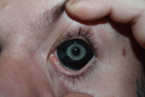 tatuajes en los ojos