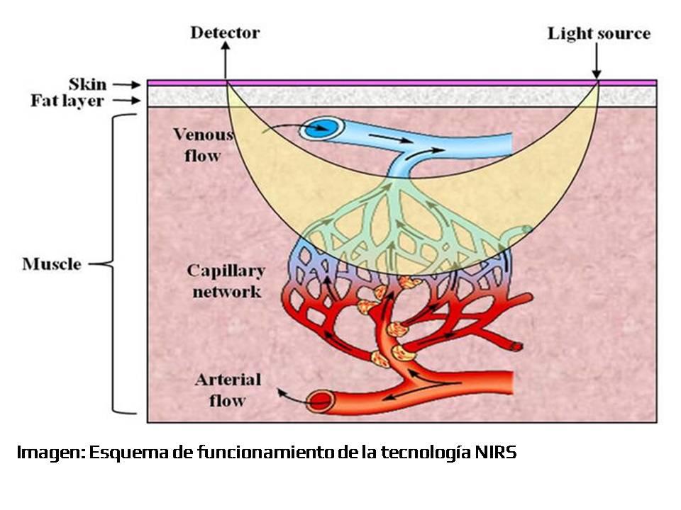 BSX Insight zitaSport 3