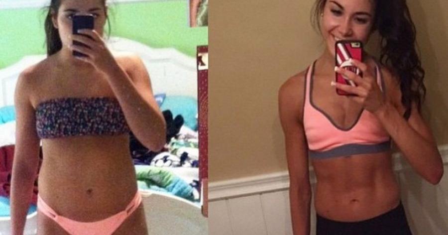Cutis perfecto antes y despues de adelgazar