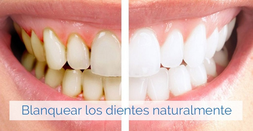 Tratamientos caseros para los dientes amarillos | Salud