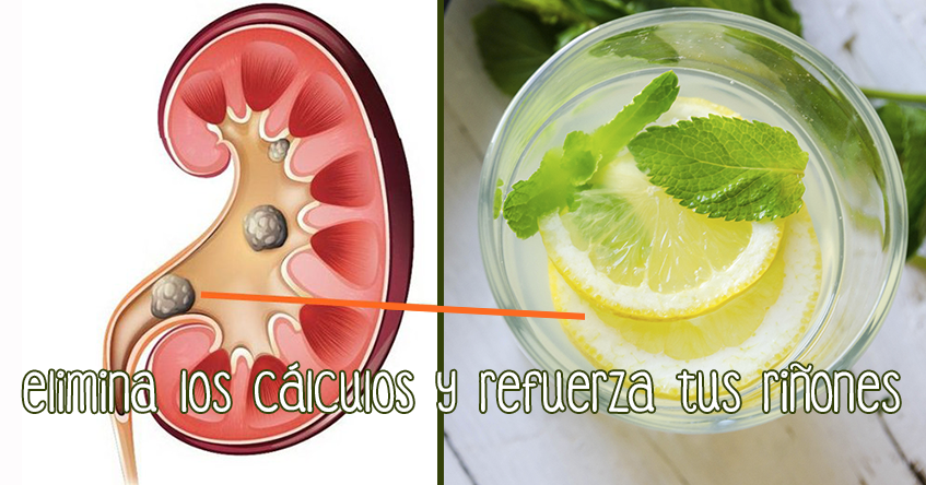 Cm3 A Litros: La Fórmula Más Sencilla Para Tus Cálculos - 1dlu6n4