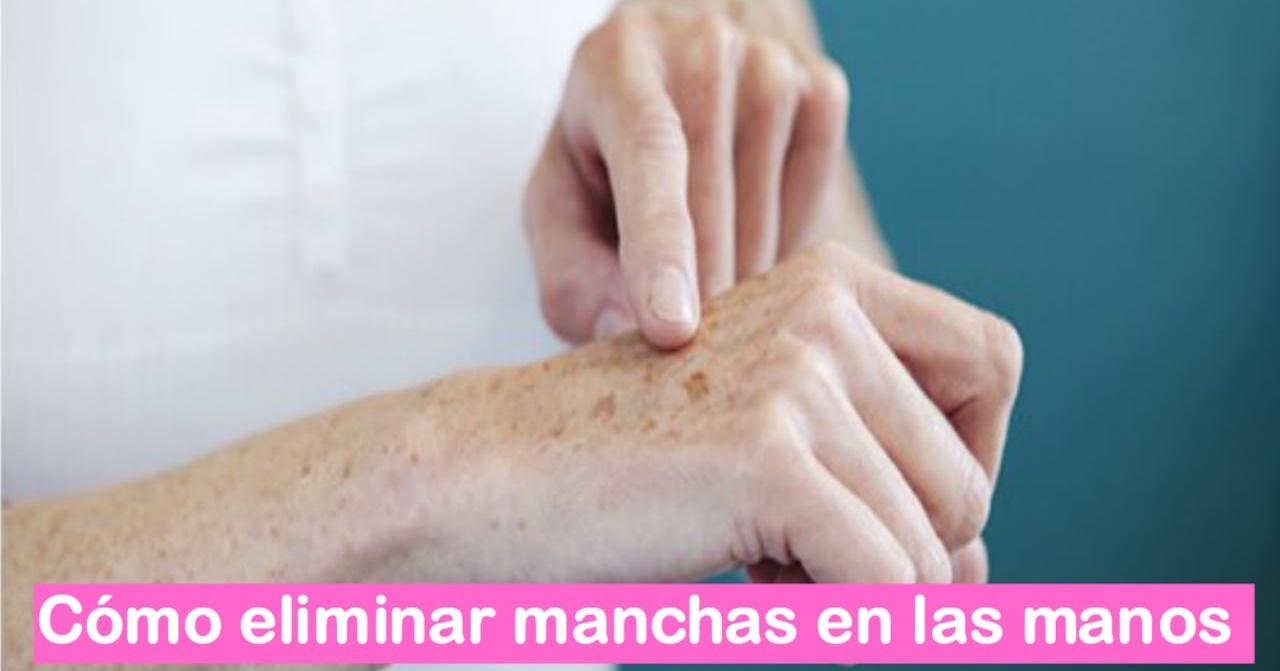 Cómo eliminar las manchas de las manos | Belleza