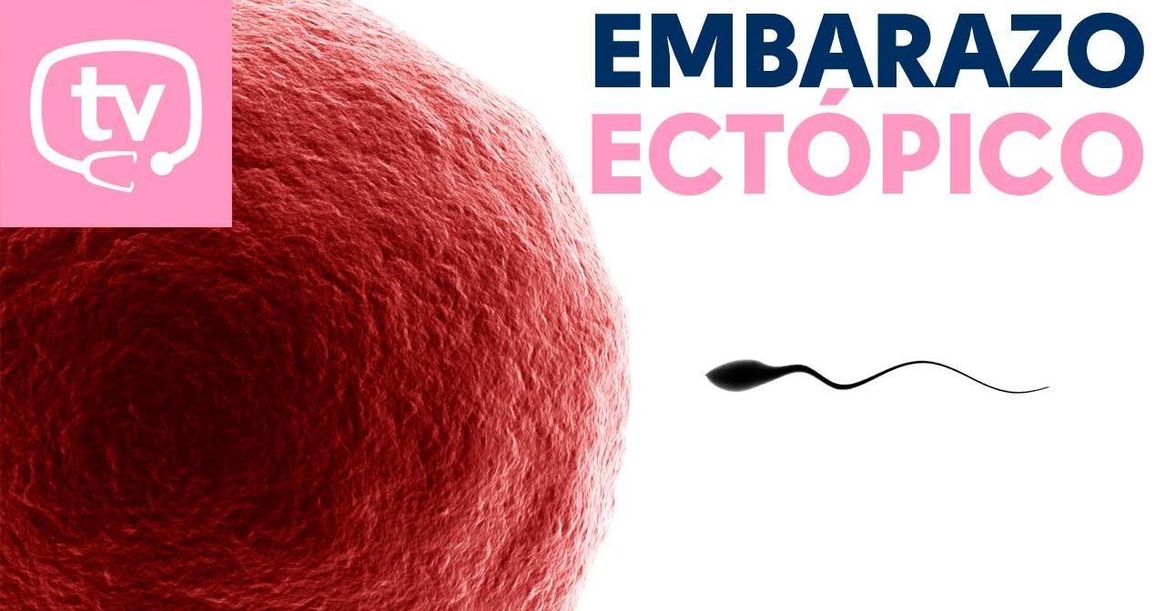 Cómo Es Posible Un Embarazo Fuera De La Matriz Salud