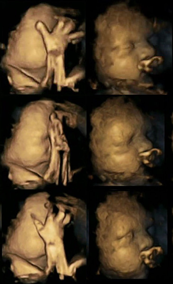 Imagen 2
