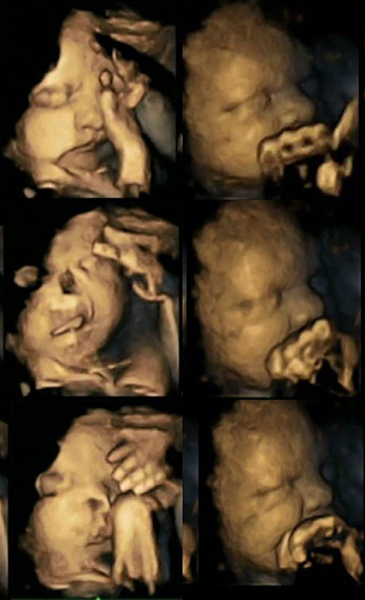 Imagen 1