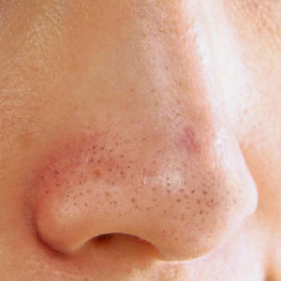 Como Quitar Espinillas Negras De La Nariz Cómo hacer tiras caseras para quitar puntos negros y espinillas | Belleza