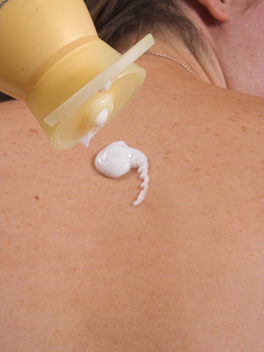crema en la espalda
