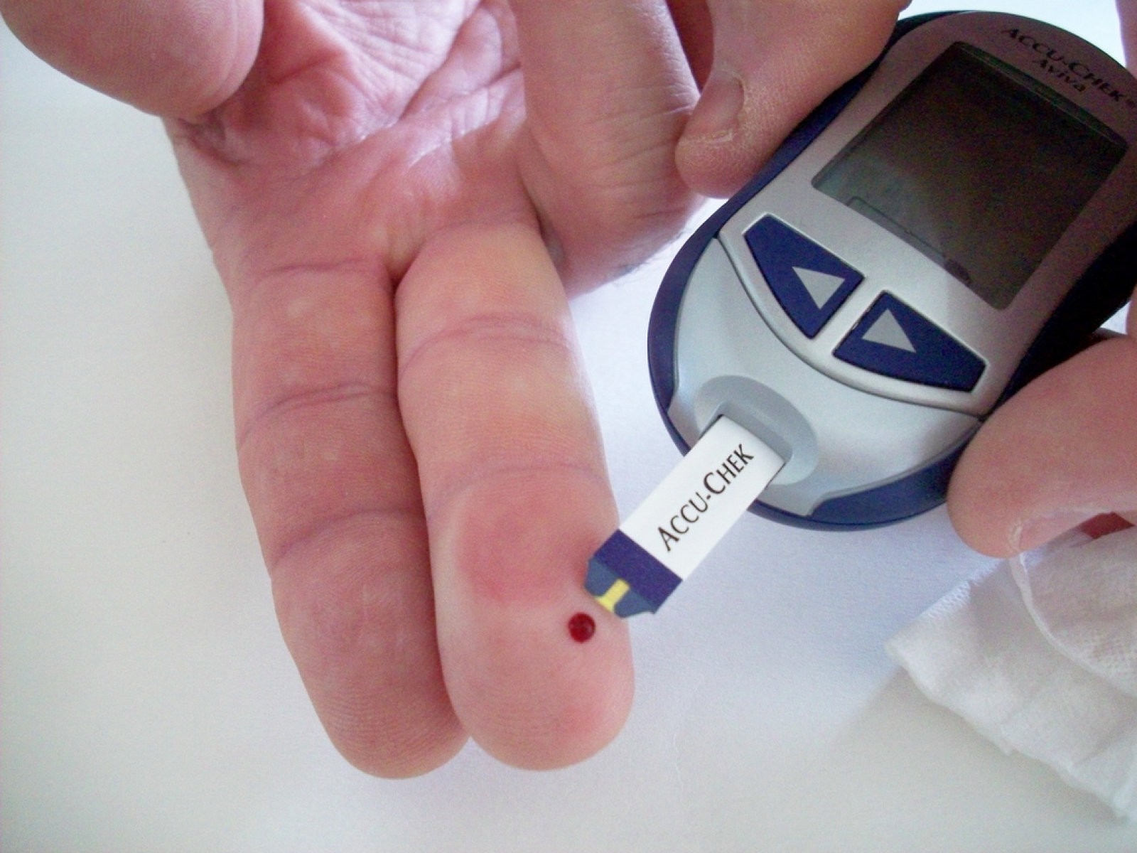 Relación entre Diabetes y Periodontitis