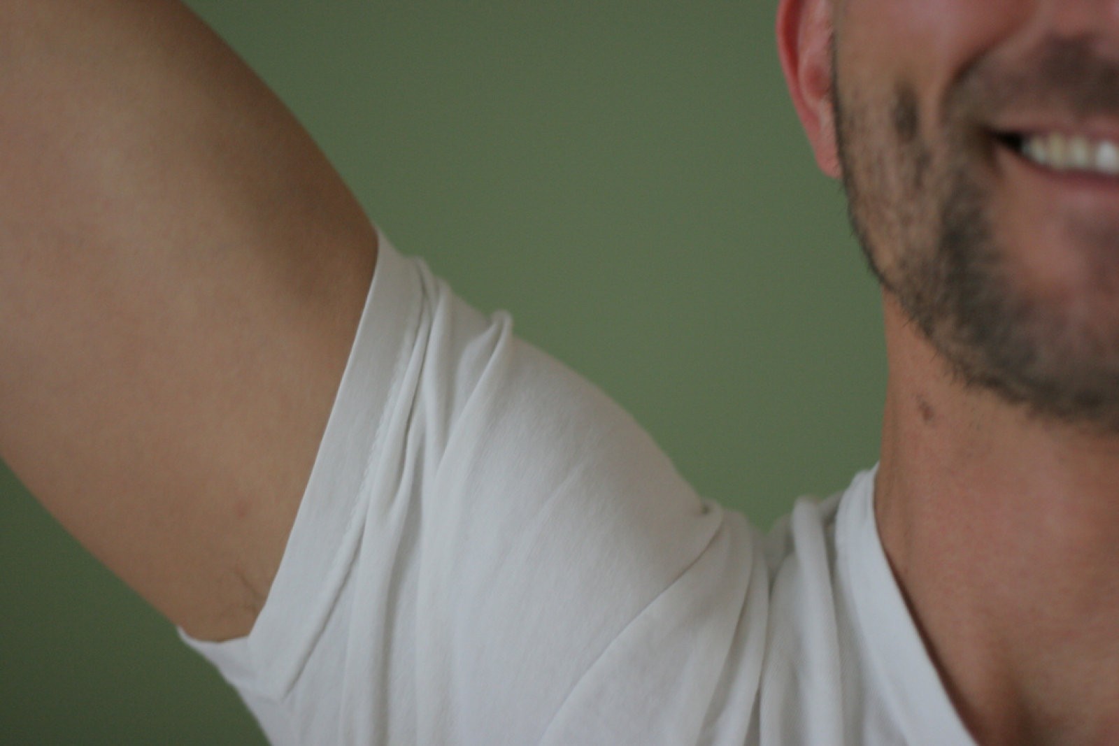 Tratamientos contra la hiperhidrosis