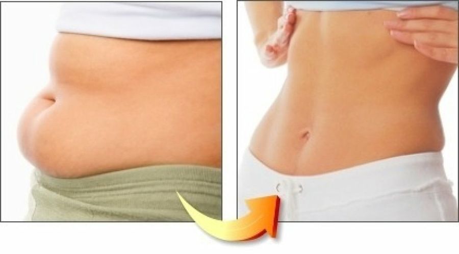 Aceite de oliva para adelgazar el abdomen