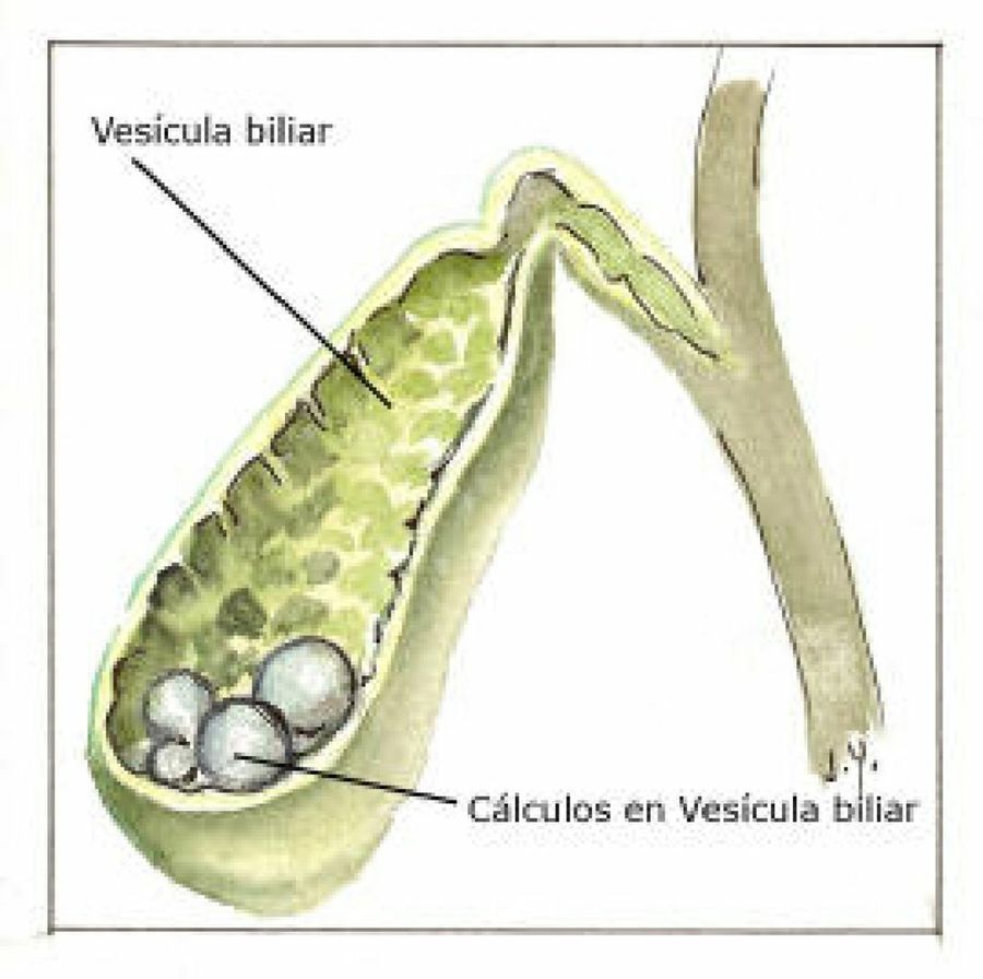 Acuta латынь. Основание пузырёк vesicula.