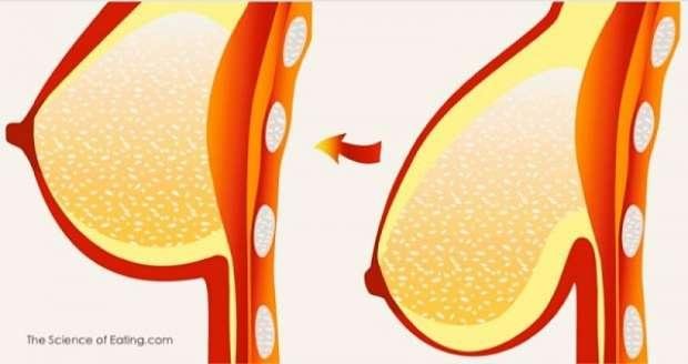 Pechos caídos: 7 remedios naturales para levantarlos sin cirugía